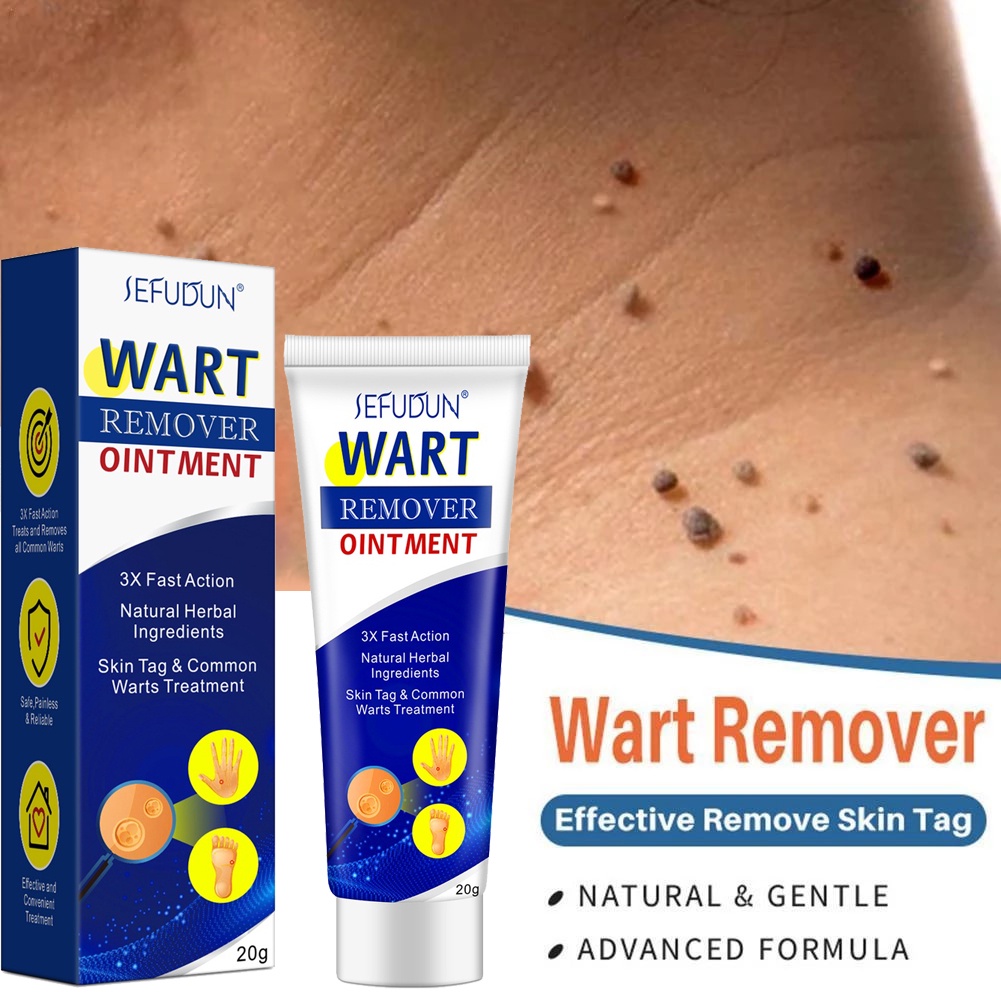 Sefudun Warts Remover Original Cream Wart Removal Ointment Skin Tag Remover Warts Remover Cream