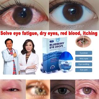 【COD】Blueberry Eye Drops | Itchy Eyes | Glaucoma | Eye Drops | Dry Eyes | Eye Drops | Sore Eyes