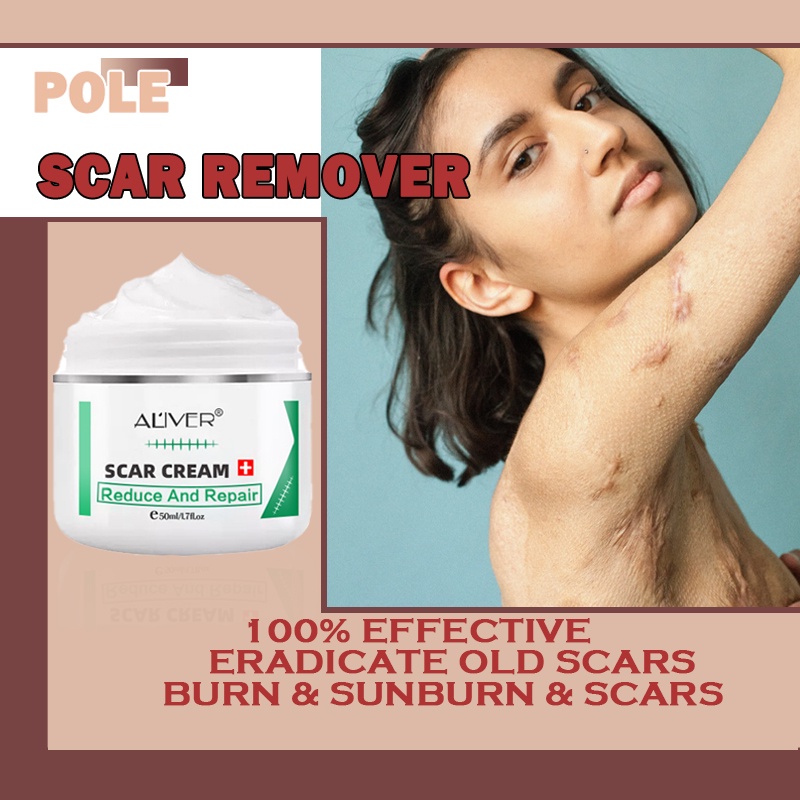 Aliver Deep Scar Remover Cream Acne Treatment Pimple Scar Removal for Old Scars Face & Body 50G
