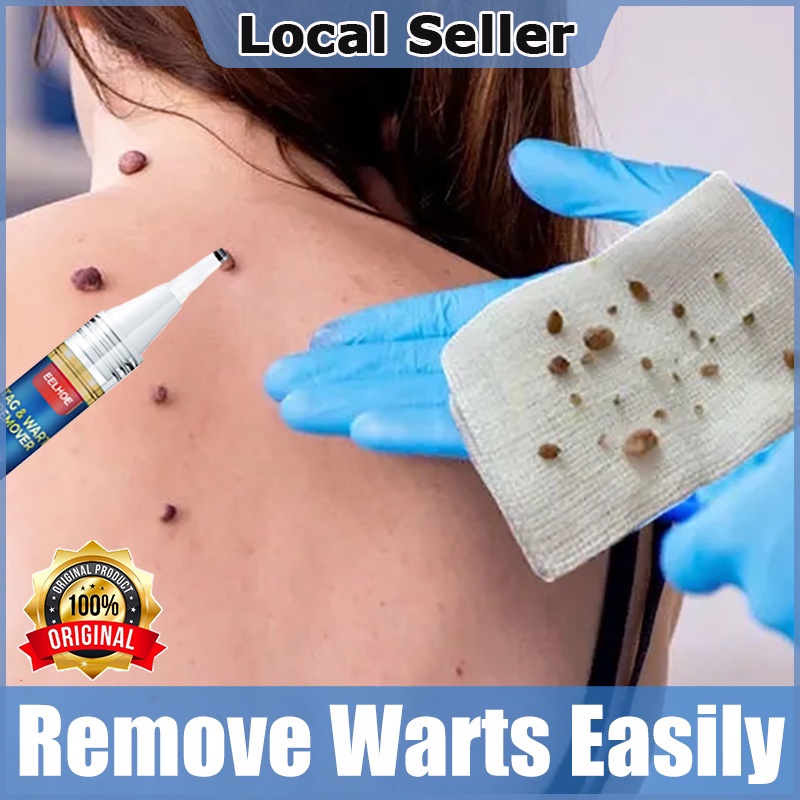 genital-wart-treatment-papillomas-removal-of-warts-liquid-from-skin