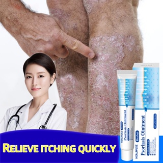 Psoriasis Antibacterial Cream Eczema Rash Treatment Dermatitis Eczematoid Eczema Herbal Ointment