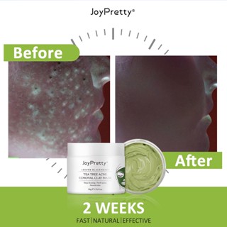 NEWCOD□Green Tea Tree Clay Mask Against Face Acne Blackhead Remover Mask Cream Facial Cleansing Bl #4