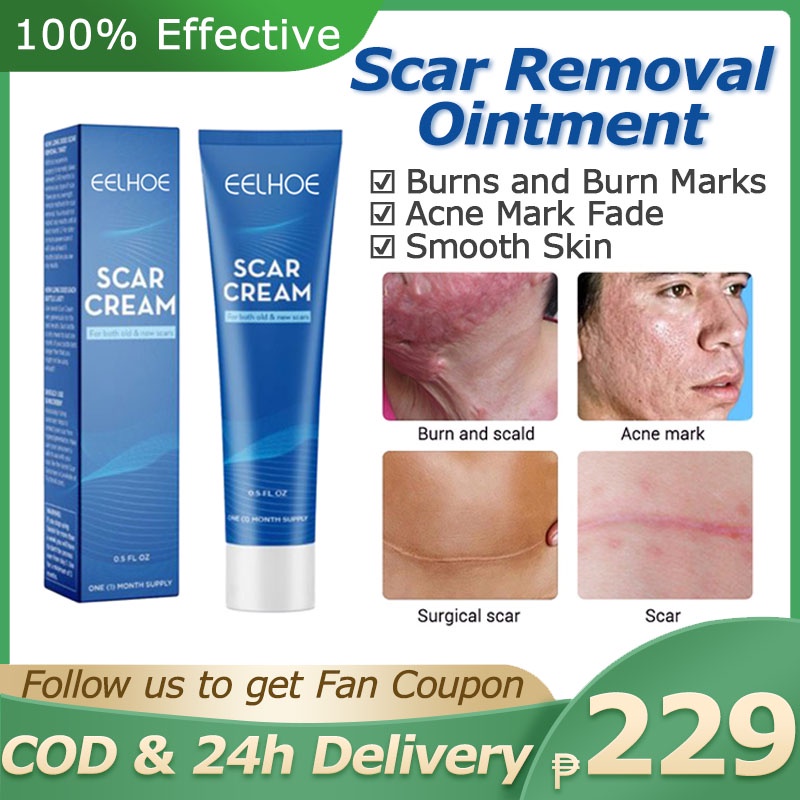 Scar Removal Cream Acne Scar Remover Stretch Mark Scald Burns Treatment ...