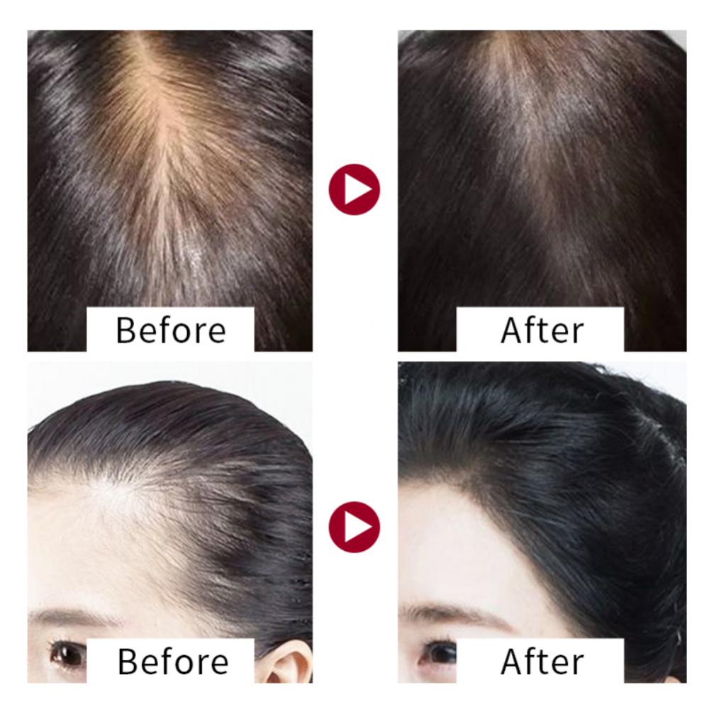 NEWHair Soap Repair Antidandruff Natural Organic Conditioner Fleeceflower Root Black Sesame Hair Dar