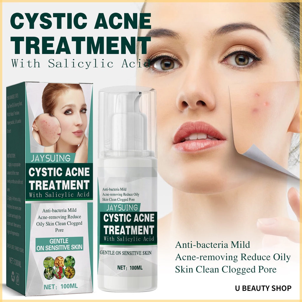 jaysuing-cystic-acne-treatment-salicylic-acid-acne-treatment-advanced