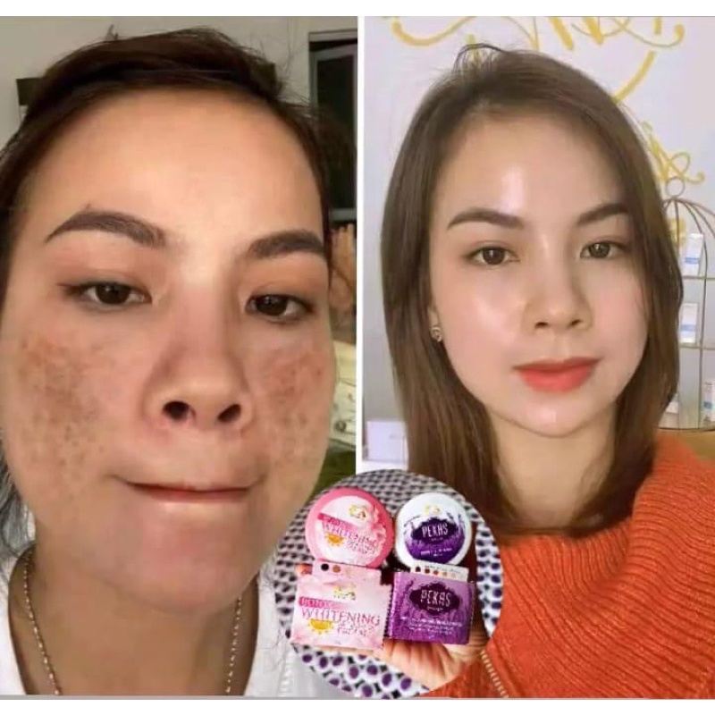 Pekas Eraser Cream And Botox Whitening Cream Spf 70 (free gift) Shopee Philippines
