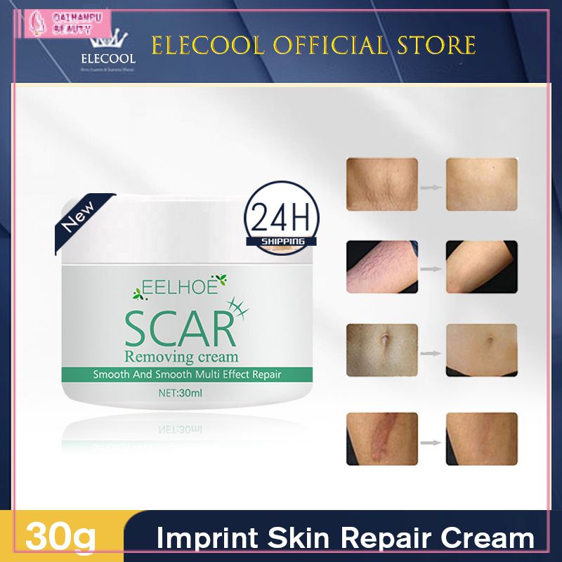 EELHOE Scar Removal Cream Effective Removes Acne Pimples Stretch Mark ...