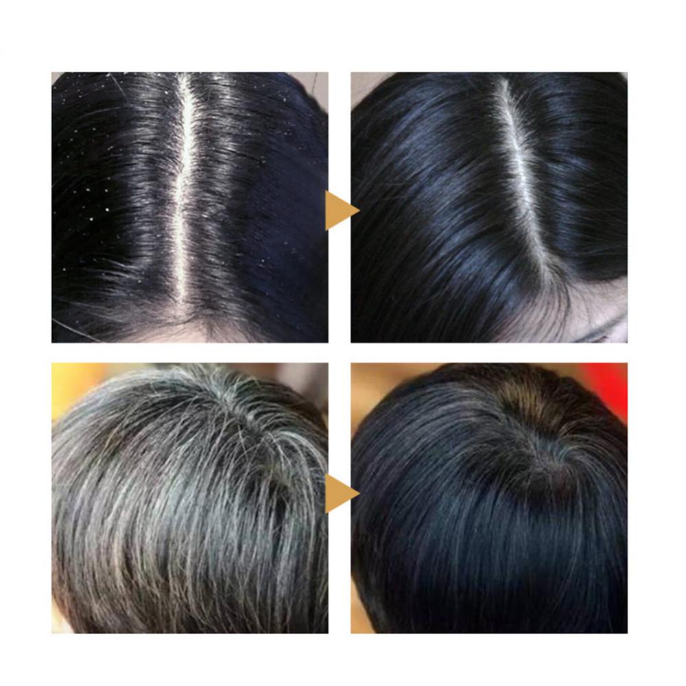 CODNEWHair Soap Repair Antidandruff Natural Organic Conditioner Fleeceflower Root Black Sesame Hair