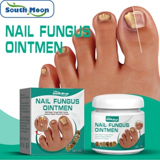 South Moon 20g Toe Nail Fungus Treatment Cream Onychomycosis Paronychia ...