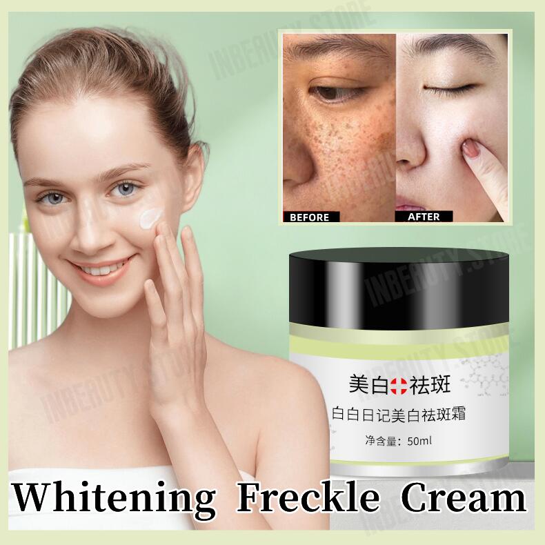 Whitening Freckle Cream Remove Melasma Cream Dark Spots Melanin Remover ...