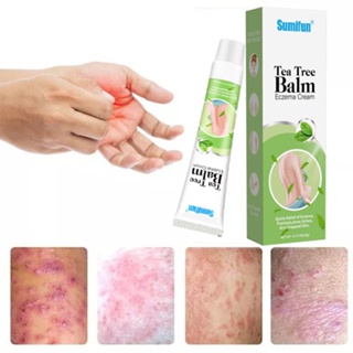Eczema Cream Itching Cream Dermatitis Itchy Skin Remedy Psoriasis Antifungal Moisturizer Ointment