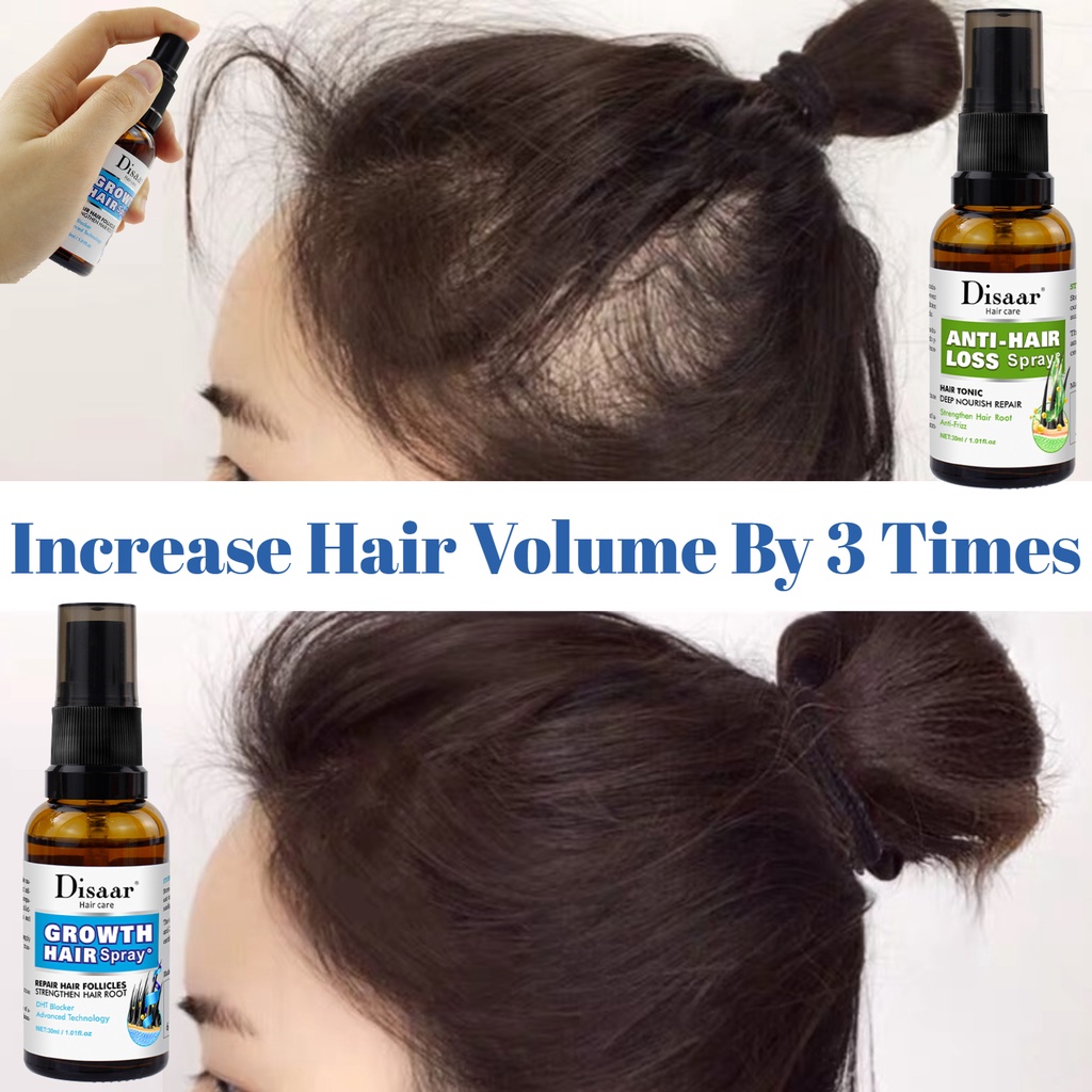 Anti Hair Loss Hair Grower Spray Ginger Novo Hair Growth Treatment