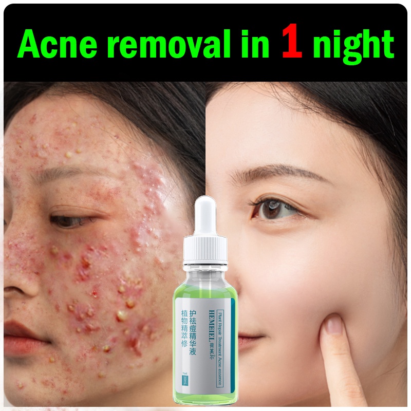 la-roche-posay-launches-effaclar-adapalene-gel-0-1-acne-treatment-allure