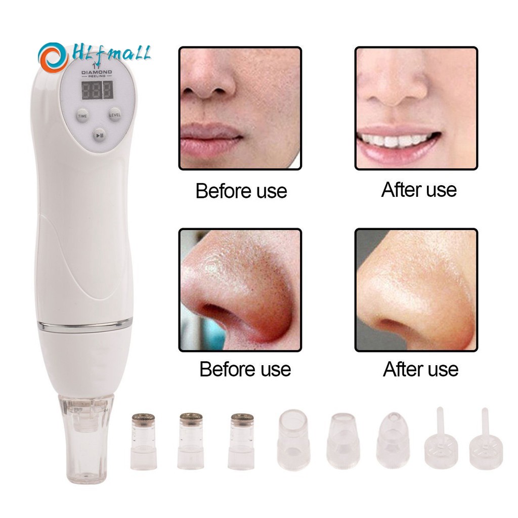 Diamond Dermabrasion Removal Scar Acne Pore Peeling Machinewax hair removal tiny buds