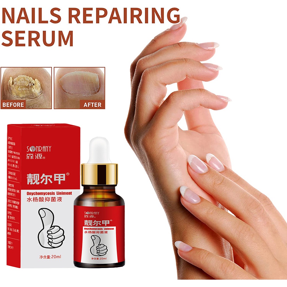 Nail Fungal Treatment Feet Care Essence Nail Foot Whitening Toe Nail