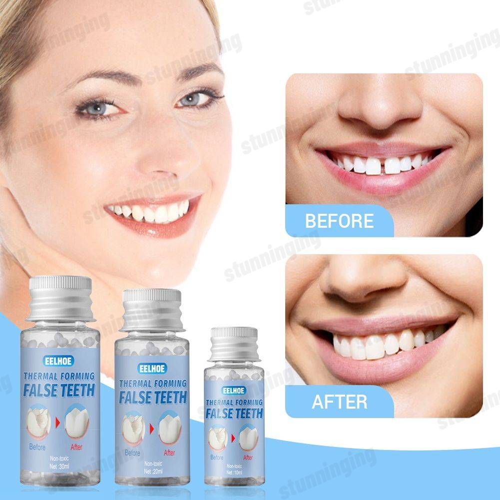 Denture Glue Repair Decorative Denture Fix The Missing Broken Teeth ...