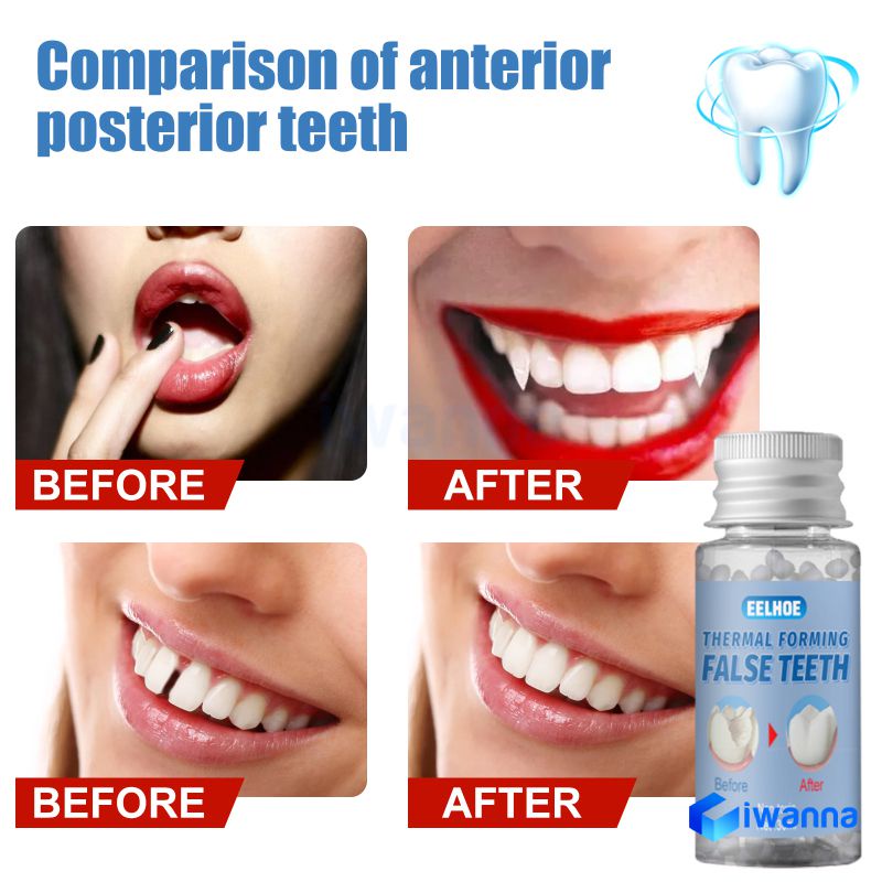 eelhoe-thermal-forming-false-teeth-for-fix-filling-the-missing-broken