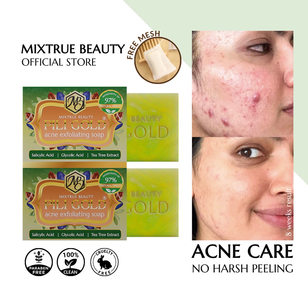 Piligold Acne Exfoliating Soap Pili Oil Pimples Mixtrue Beauty Shopee
