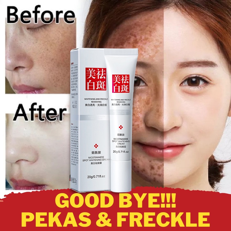 Brightening Corrector Melasma Treatment Whitening Freckle Remove Cream - Whitening Freckle Remove Cream and Freckles Cream price
