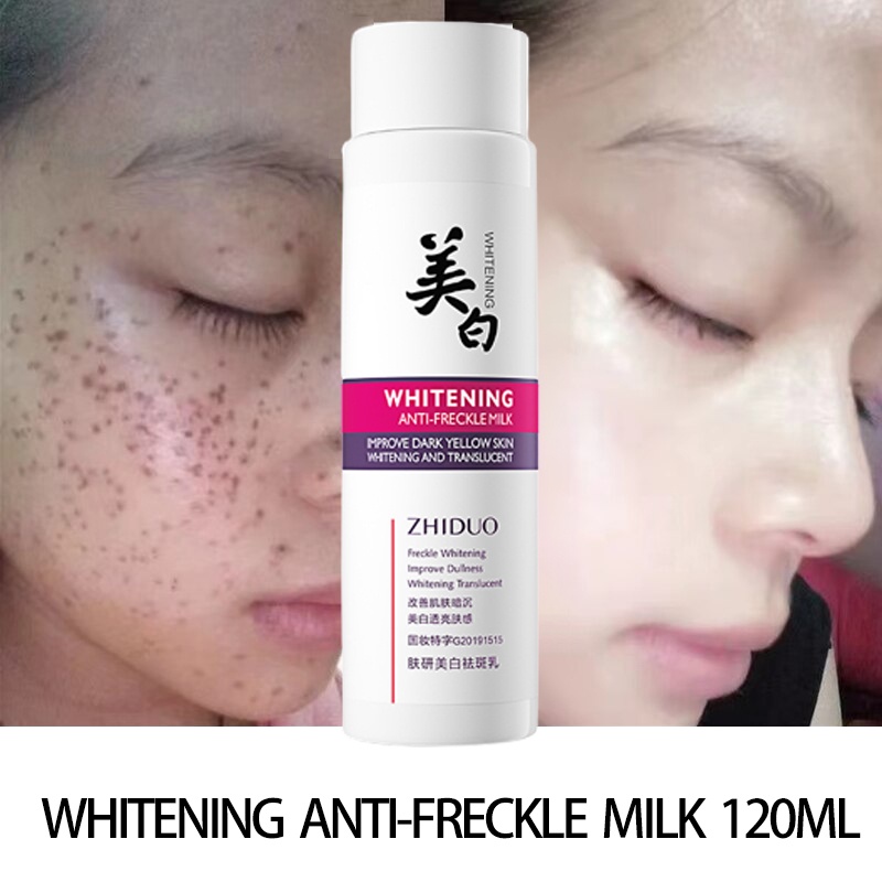 120ml Niacinamide Whitening Freckles Lotion Melasma Cream Pekas Remover ...