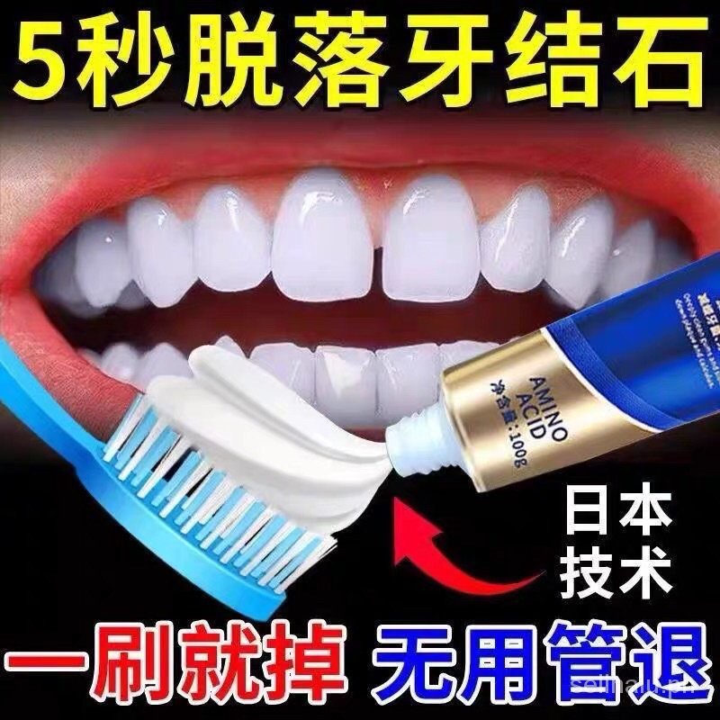 Tooth stone removing whitening toothpaste antihalitosis tooth scale