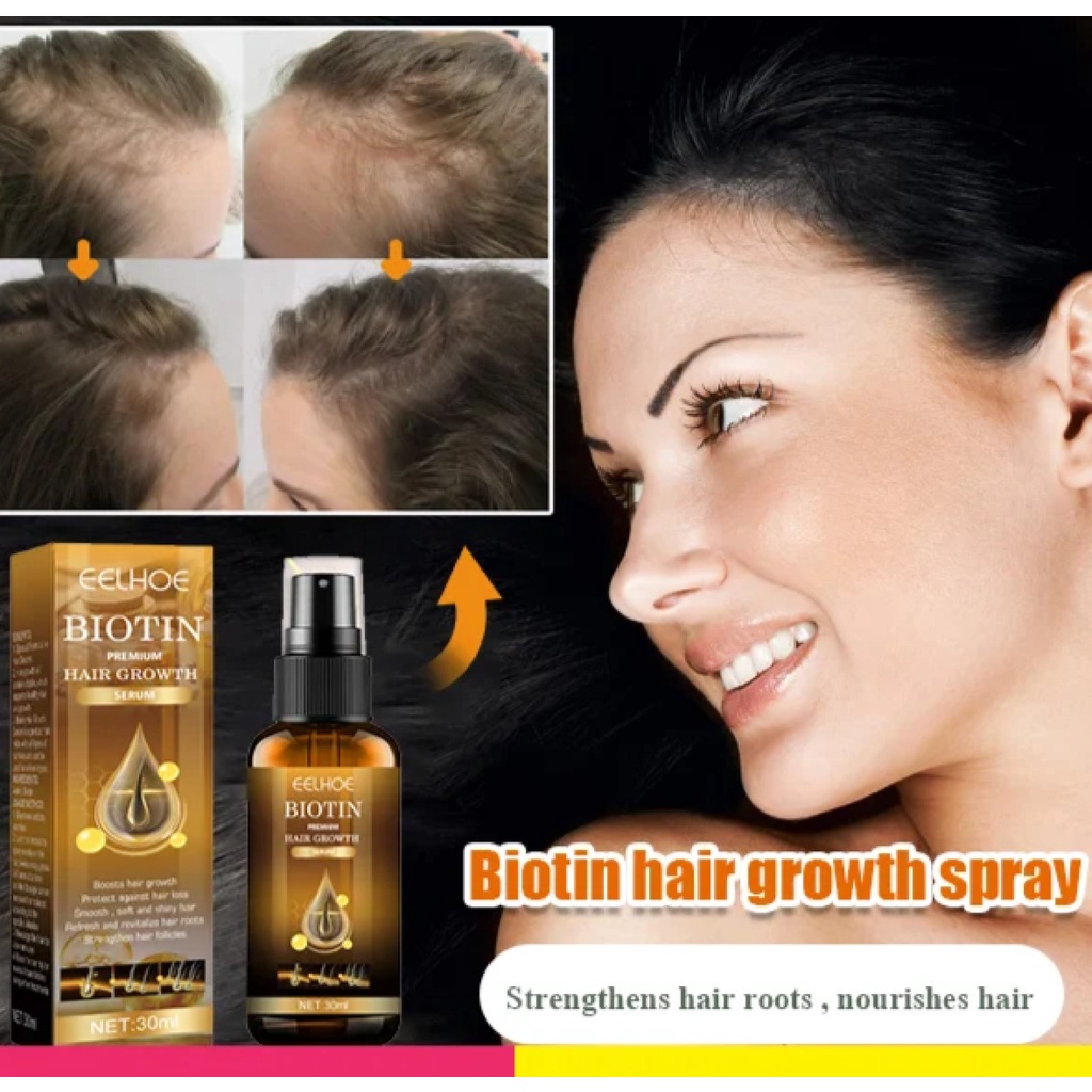 EELHOE Biotin Hair Growth Spray 30ml | Shopee Philippines