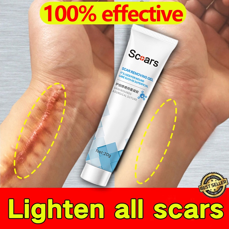 YANJIAYI Scar Remover Cream Scar Repair Gel Pregnancy Surgery Burn