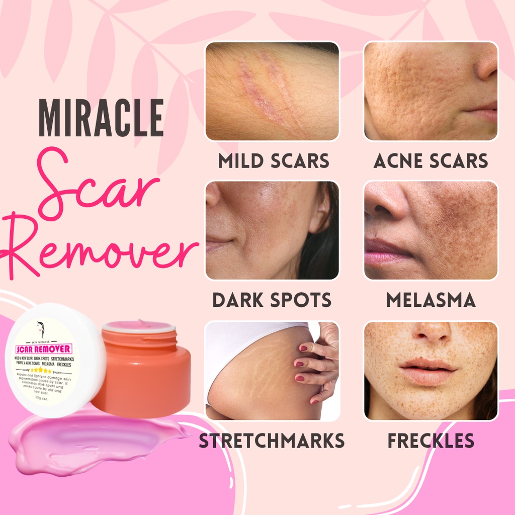 Miracle Scar Remover (Removes Mild Scars, Acne Scars, Dark spots