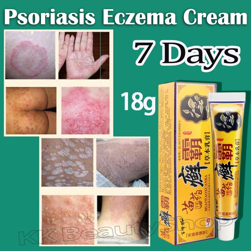 Eczema Cream Psoriasis Cream Antibacterial Cream Relief Skin Itch