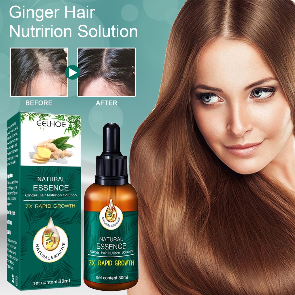 EELHOE Minoxidil Hair Grower 30ml Ginger Hair Treatment Hair Loss