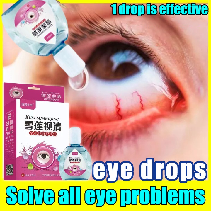 30ml rohtoz /visine/cmd/bioline eye drops contact lens eye care for dye