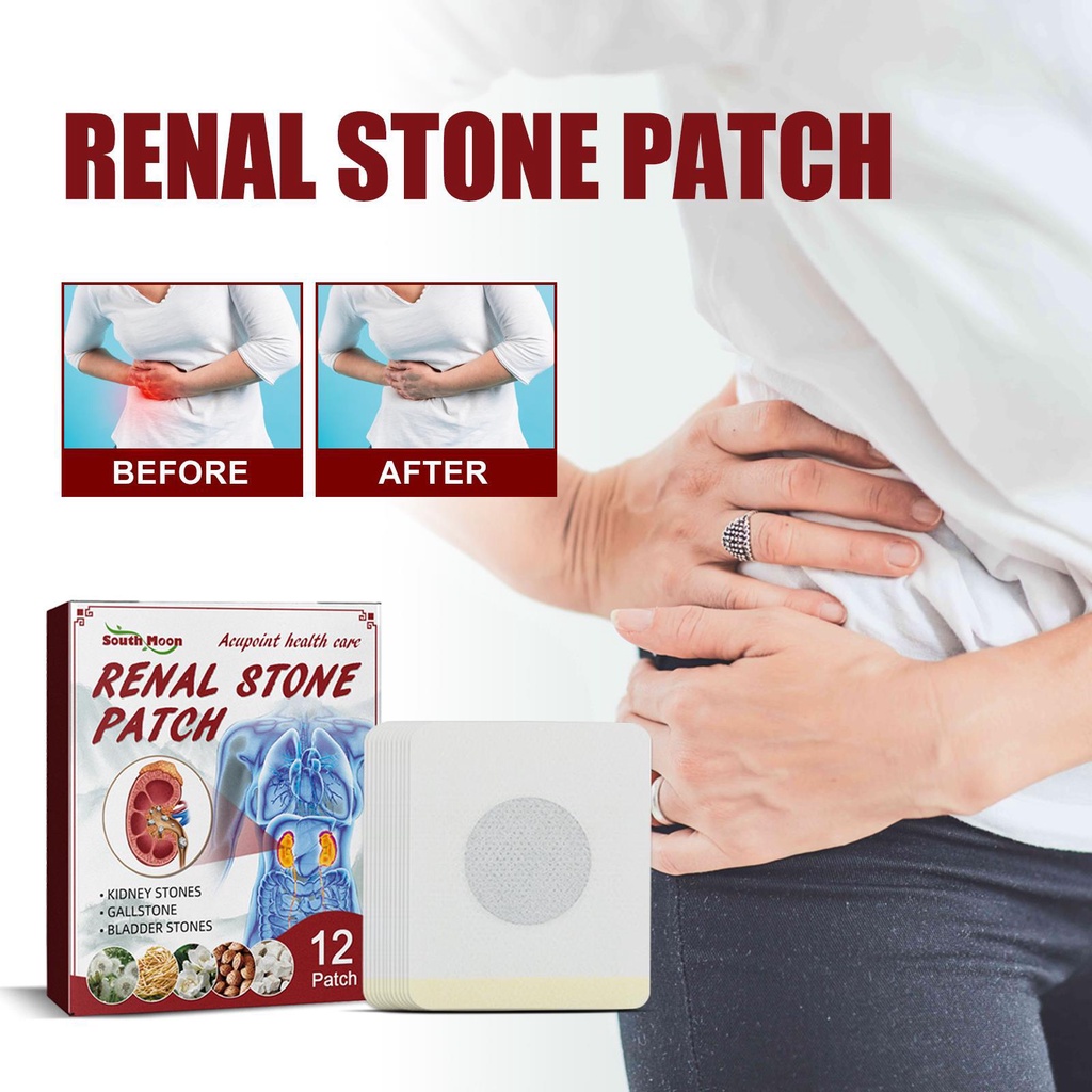 south-moon-renal-stone-patch-renal-pain-relief-patch-chinese-herbal