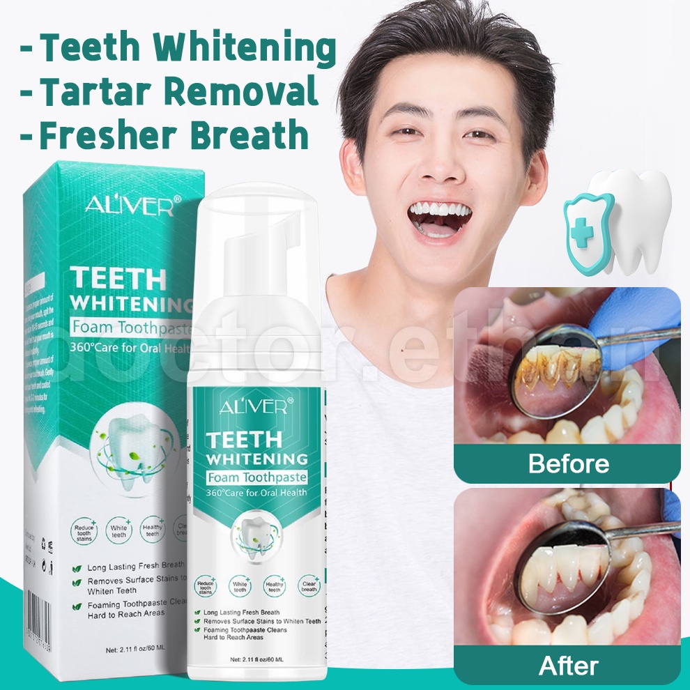 ALIVER Teeth Whitening Mousse Toothpaste Remove Tartar Remove Plaqu Oral  Odor Bright Teeth | Shopee Philippines