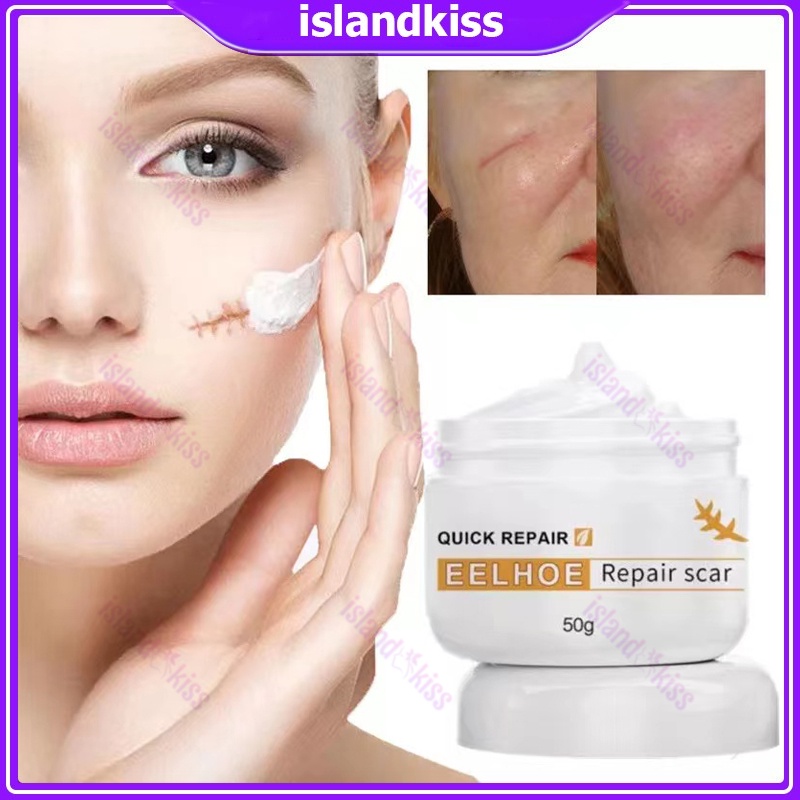 Scar Remover for Old Remover Cream for Old Scar on Leg Remove Stretch Mark Remover Acne Scar
