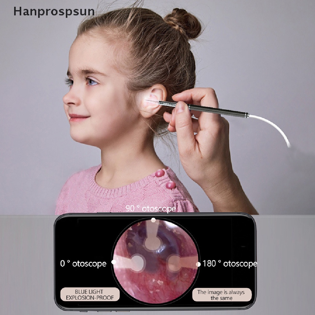 Hanprospsun> 1Set Smart Ear Cleaner Endoscope Spoon Visual Earpick