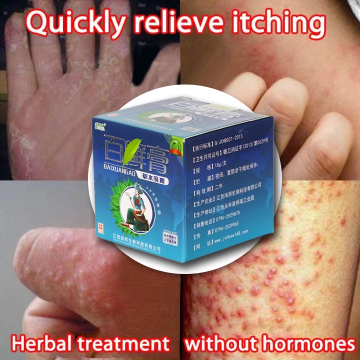 100% Effective Hundred Ringworm Cream Psoriasis Ointment Eczema Cream