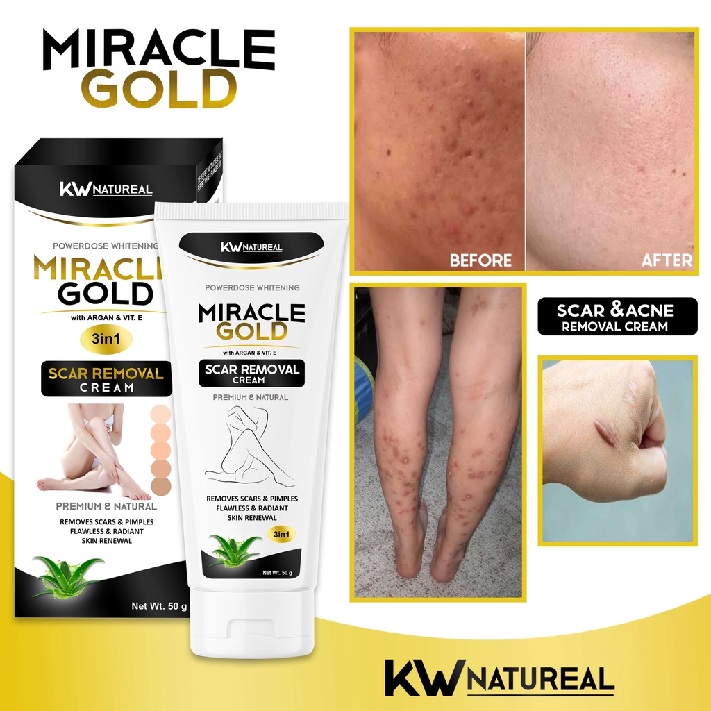 MIRACLE GOLD SCAR & PIMPLE REMOVER CREAM 50g [EFFECTIVE] PEKLAT, OLD