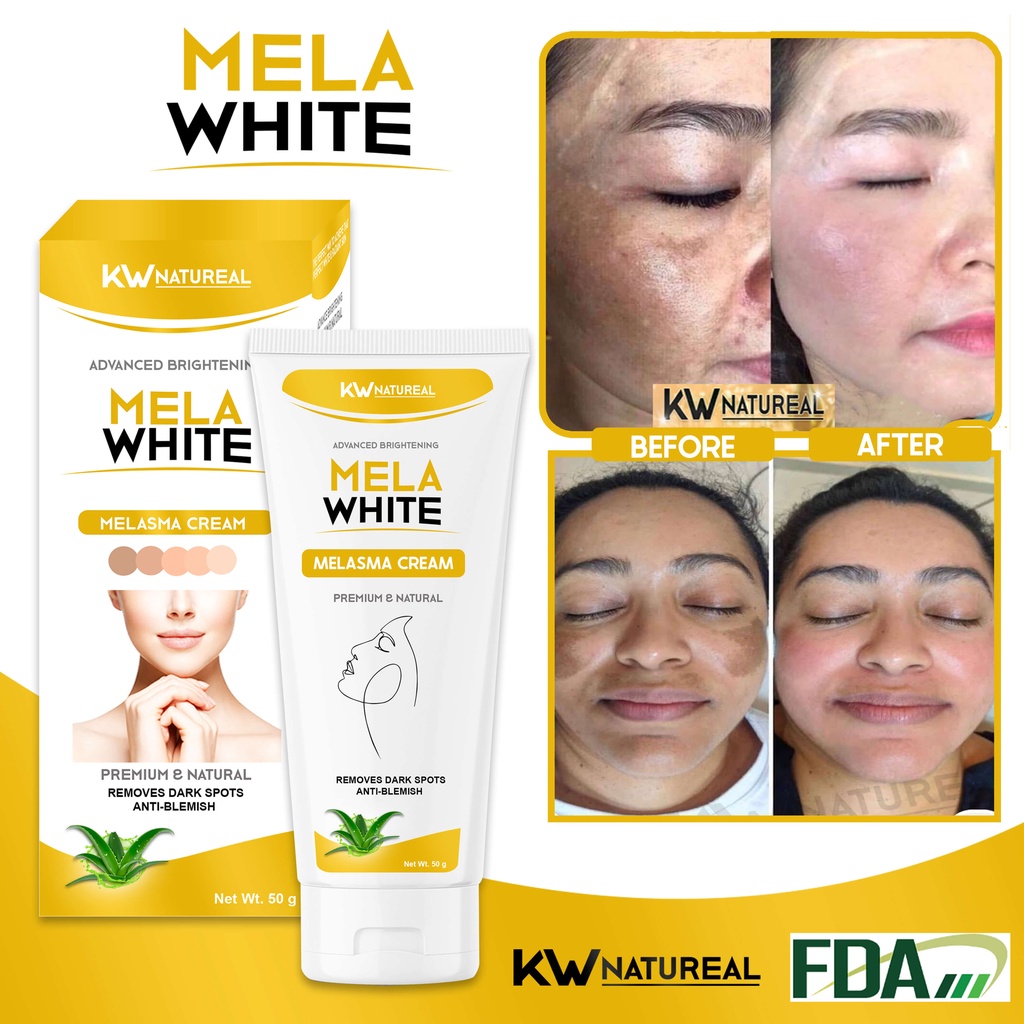 MELAWHITE MELASMA CREAM 50g [FDA APPROVED] FOR PEKAS, FRECKLE, MELASMA