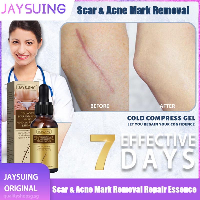 Scar Remover for Old Scar on Leg Scar removal cream for old scars