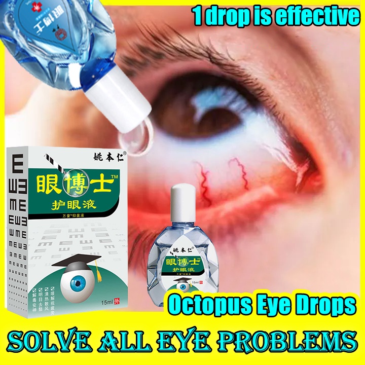 Rohto Eye Drops 15ml (Direct from JAPAN)Cool 40a/Vita 40a/ Rohto Z/Eyedrop/Itchy Eyes/Dry Eyes