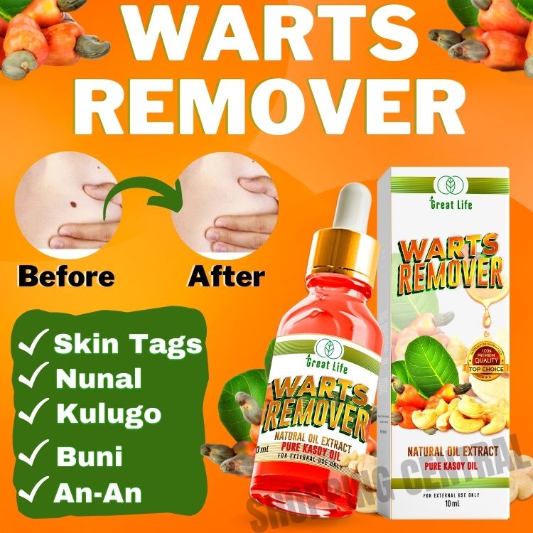 Warts Kasoy Remover Cream Skin Tag Mole Cream Remover Original Warts Cream Kasoy Warts Removal