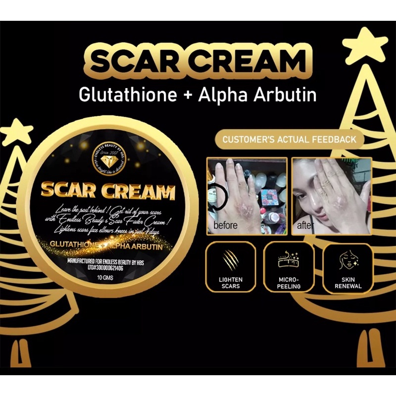 SCAR removal cream for adult /peklat remover/scarminator cream original