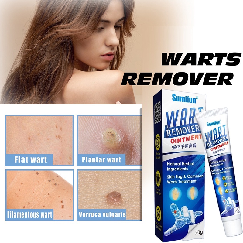 Warts Remover Original Cream Effective Painless Wart Removal Ointment ...