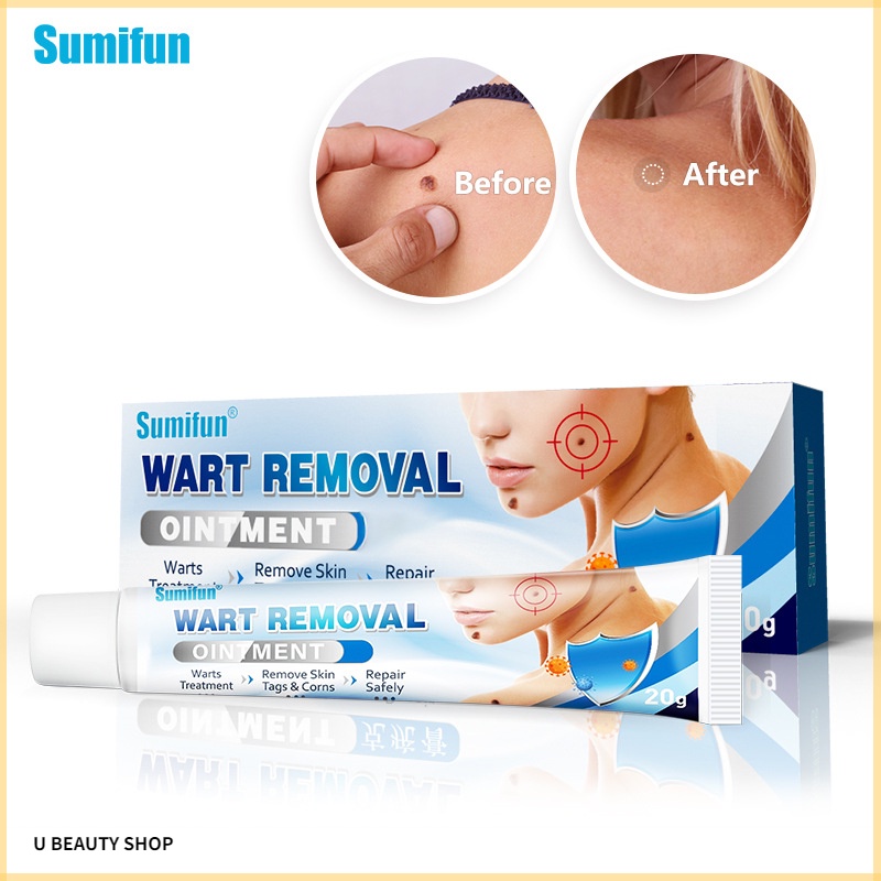 Sumifun Wart Remove Antibacterial Ointment Wart Treatment Ointment Skin Cream Tag Corn Plaster