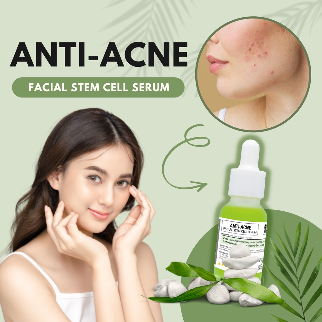 AntiAcne Facial Stem Cell Serum (Say Goodbye to Acne & Acne Scars