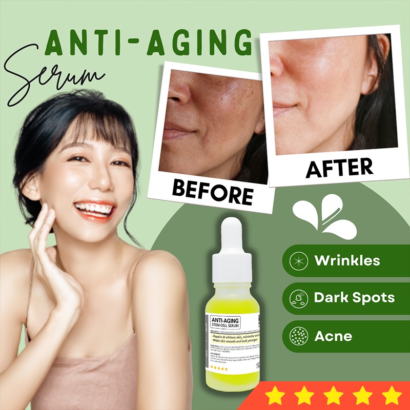 Goodbye Wrinkles, Dark Spots, Acne & Fine lines - Anti-Aging Stem Cell
