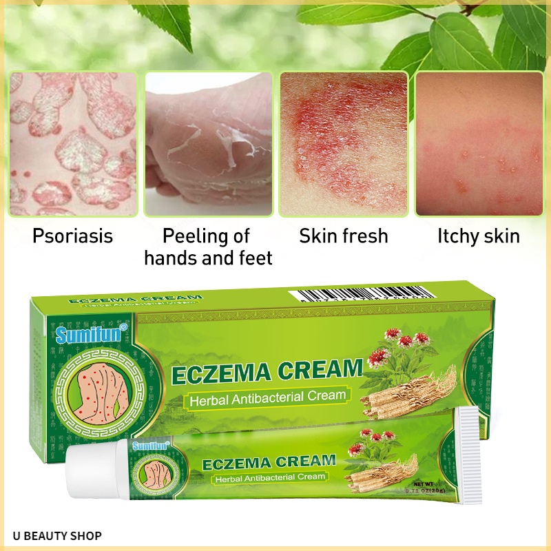 Sumifun 1pcs Treatment Psoriasis Cream Antibacterial Antipruritic Dermatitis Eczema Herbal 3709