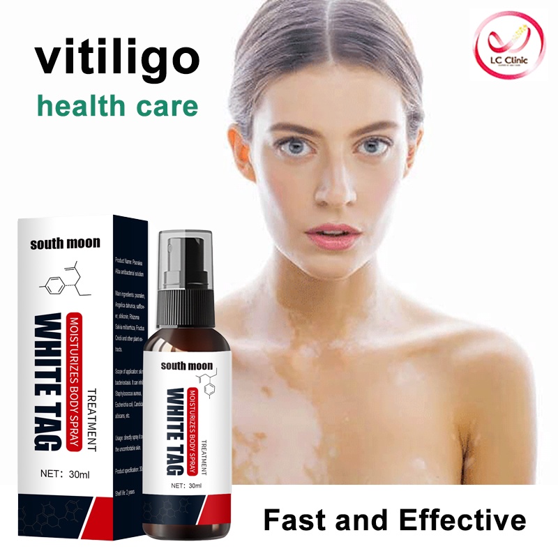 Vitiligo Treatment Cream White Spot Disease Cream vitiligo remover ...