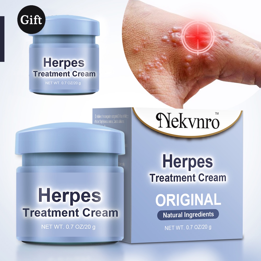 Buy 1 Get 1 Nekvnro Herpes Zoster Cream Gamot Sa Buni Herpes Relief ...