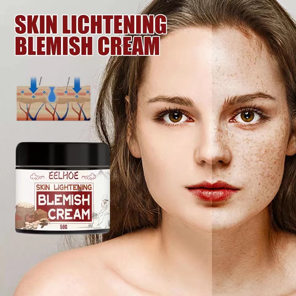 EELHOE Blemish Melasma Cream Pekas Remover 50g Original Dark Spot